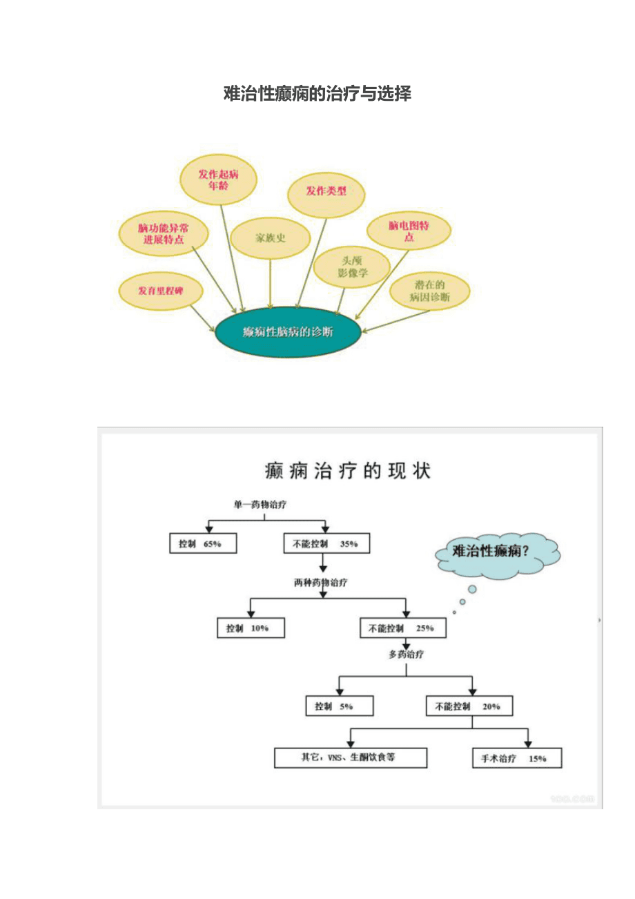 最新癫痫疗法，希望之光引领未来治疗方向