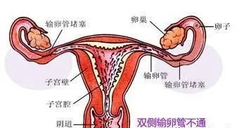 通草的功效与作用能通输卵管堵塞_全面解答解释落实_V190.128.122.114